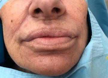 estética 2