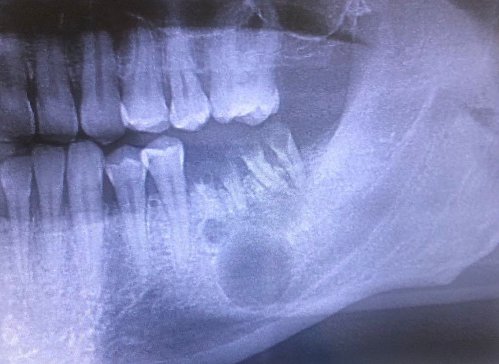 cirugia oral 1