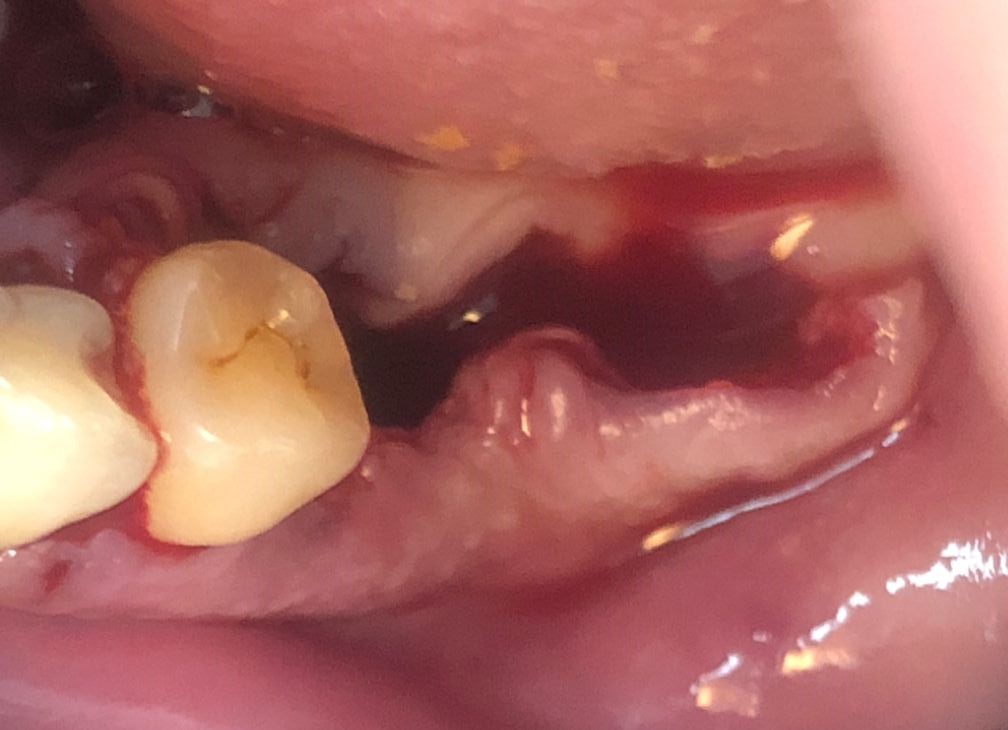 cirugia oral 2